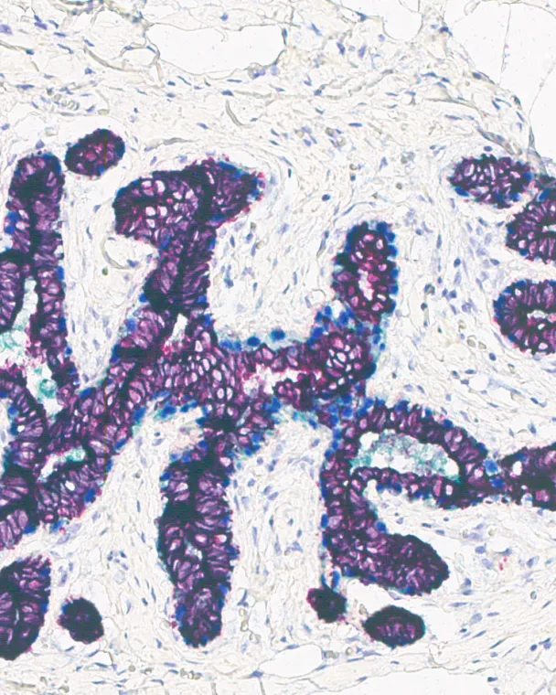 Multi-plex stain image from Leica Bio