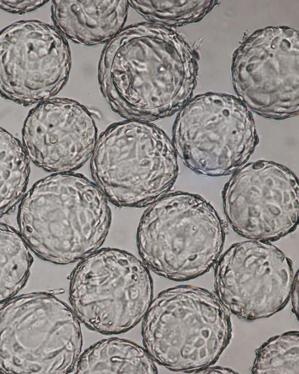 Vero cells on Cytodex 1 gamma in VaccineXpress medium in spinner flask