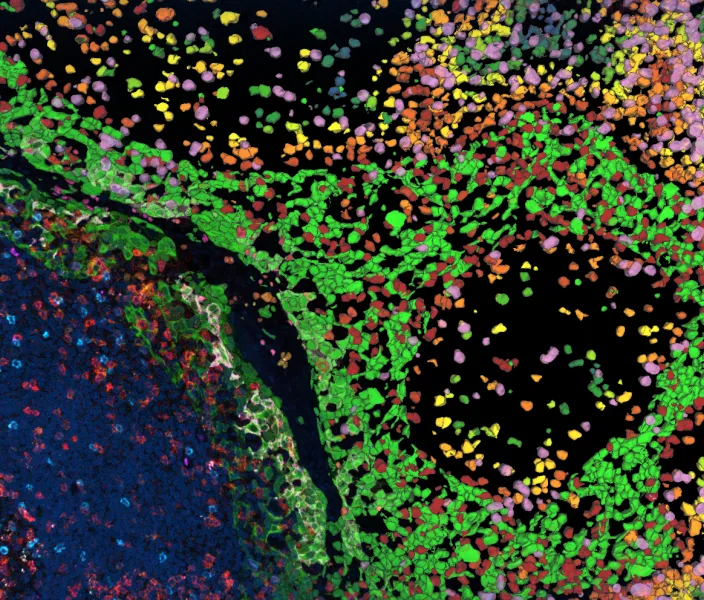 3D human tonsil tissue