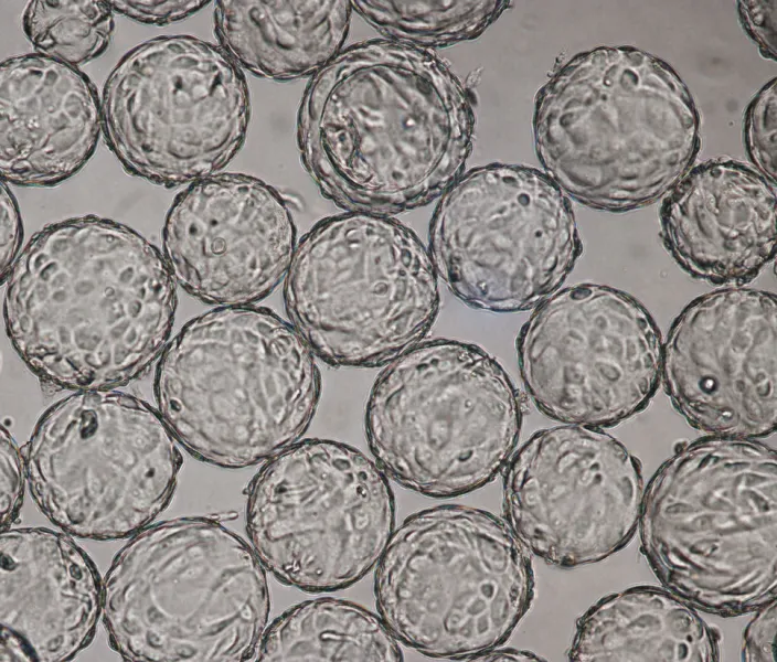 Vero cells on Cytodex 1 gamma in VaccineXpress medium in spinner flask