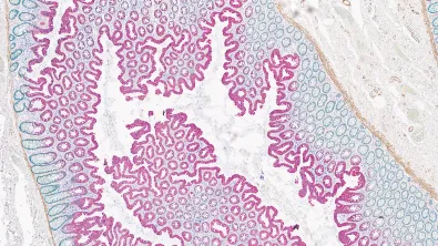 Colon tissue stained using the BOND RX and imaged with an Aperio digital pathology scanner.