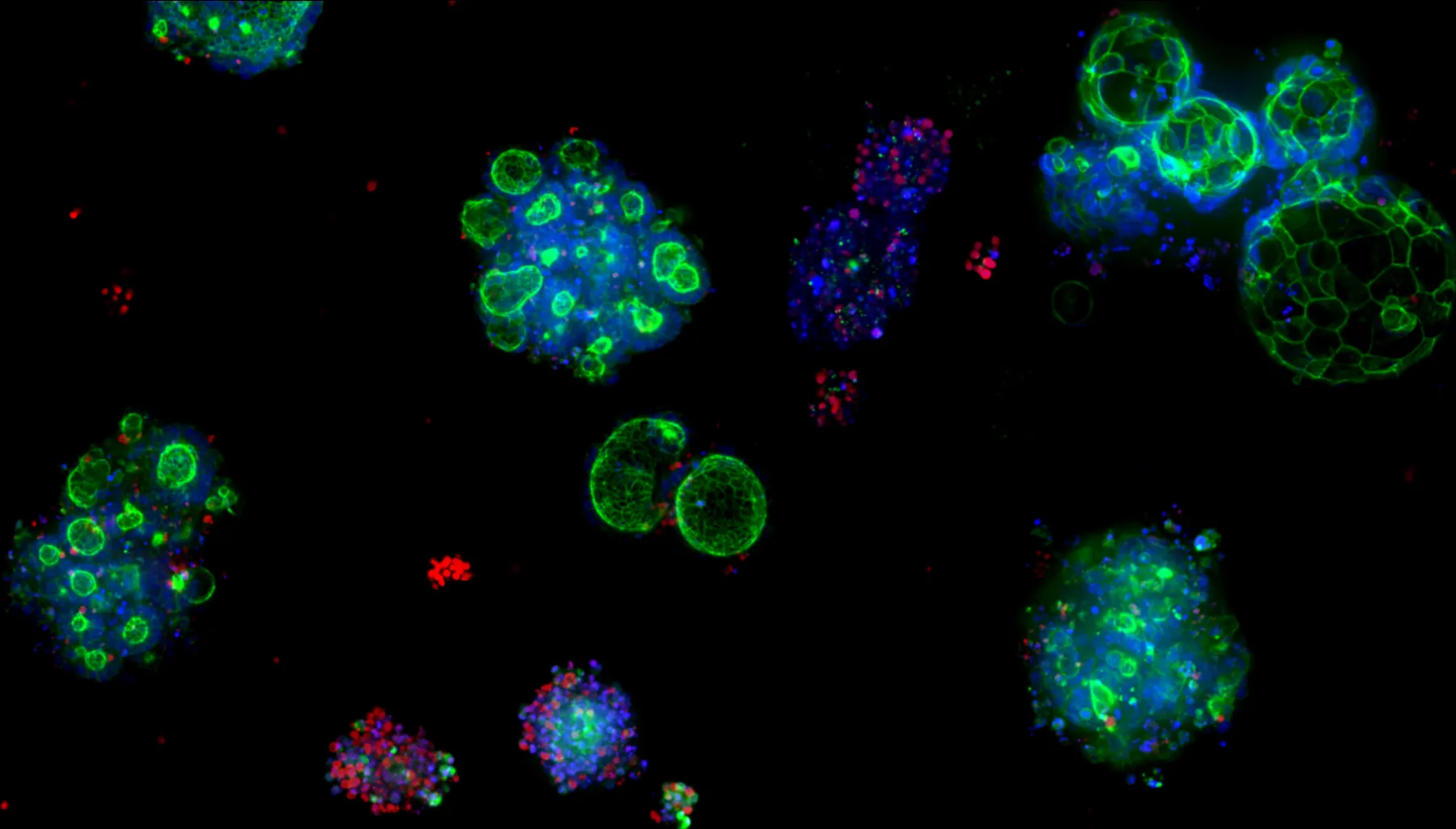 Colorectal cancer organoids