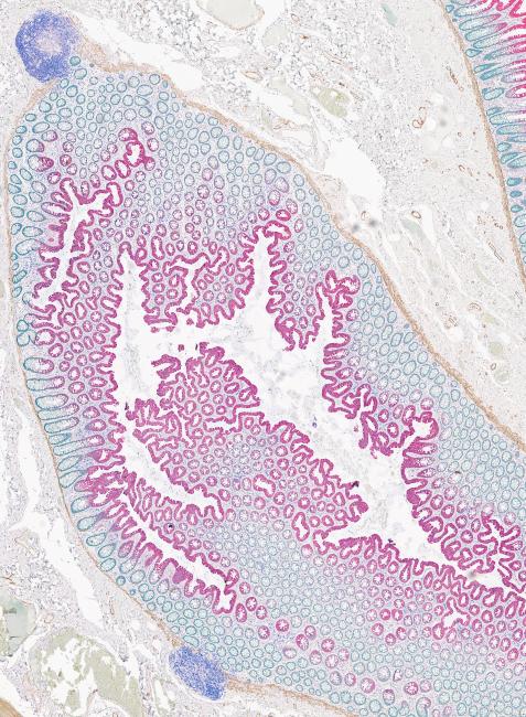 Colon tissue stained using the BOND RX and imaged with an Aperio digital pathology scanner.